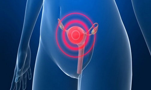 cáncer de cuello de útero