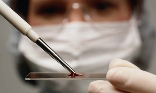 kit diagnostico diarreia